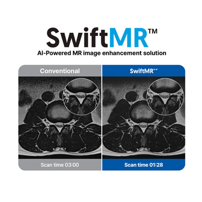 Software AI per MRI -> SwiftMR